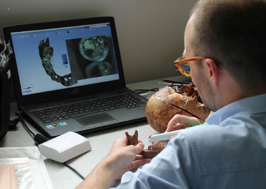 Réalisation d'un scanner surfacique de la mandibule d'Anne d'Alègre par l'équipe d'odontologie du CAGT (UMR 5288) et CHU Rangueil de Toulouse. © Rozenn Colleter, Inrap